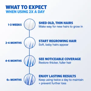 Men’s Rogaine Extra Strength 5% Minoxidil Topical Solution Hair Regrowth Treatment – (1-Month Supply)